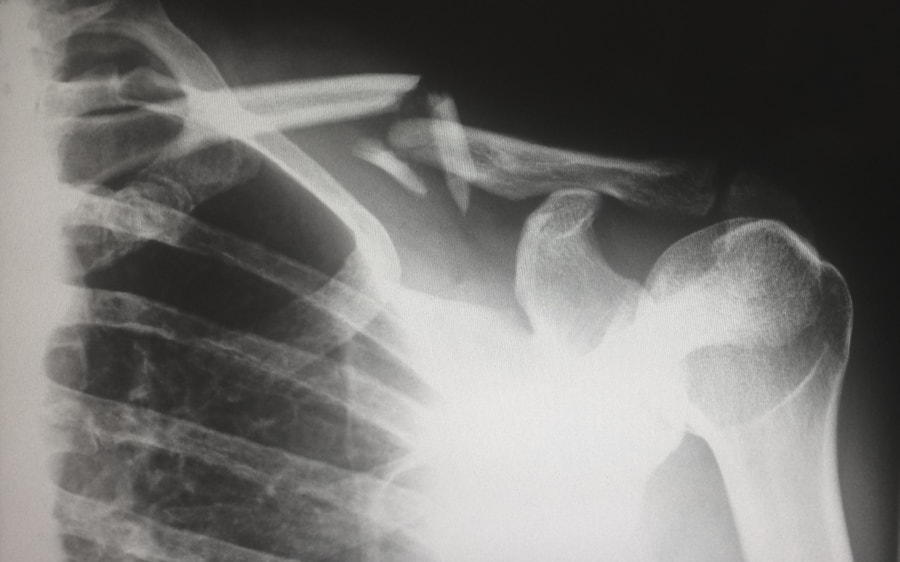 Radiology medical imaging